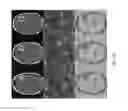 Fig. 12 - Magnetic resonance maps for analyzing tissue