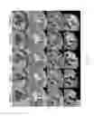 Fig. 15 - Magnetic resonance maps for analyzing tissue