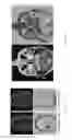 Fig. 18 - Magnetic resonance maps for analyzing tissue