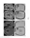 Fig. 21 - Magnetic resonance maps for analyzing tissue
