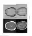 Fig. 22 - Magnetic resonance maps for analyzing tissue