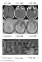 Fig. 23 - Magnetic resonance maps for analyzing tissue