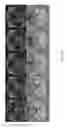 Fig. 24 - Magnetic resonance maps for analyzing tissue