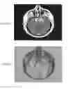 Fig. 25 - Magnetic resonance maps for analyzing tissue
