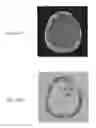 Fig. 26 - Magnetic resonance maps for analyzing tissue