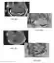 Fig. 27 - Magnetic resonance maps for analyzing tissue
