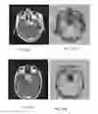 Fig. 28 - Magnetic resonance maps for analyzing tissue