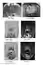 Fig. 29 - Magnetic resonance maps for analyzing tissue