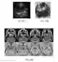 Fig. 30 - Magnetic resonance maps for analyzing tissue