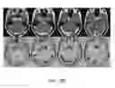 Fig. 31 - Magnetic resonance maps for analyzing tissue