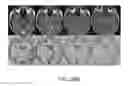 Fig. 33 - Magnetic resonance maps for analyzing tissue