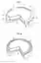 Fig. 05 - Mounting fixture of elastic seal member
