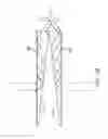 Fig. 94 - Using a freedom reflective and lens optical component for augmented or virtual reality display