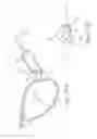 Fig. 15 - Accessory for glasses