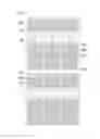 Fig. 09 - Curved display device having plurality of subpixel electrodes formed in plurality of columns