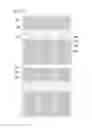 Fig. 12 - Curved display device having plurality of subpixel electrodes formed in plurality of columns