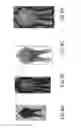 Fig. 14 - Silhouette-based limb finder determination