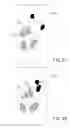 Fig. 09 - Method of identifying palm area of a touch panel and a updating method thereof