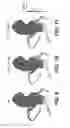 Fig. 08 - Method and system for image processing to determine patient-specific blood flow characteristics