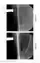 Fig. 10 - Measuring atmospheric attributes using multispectral images