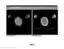 Fig. 03 - Method for acquiring and processing medical images