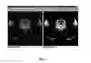 Fig. 04 - Method for acquiring and processing medical images