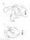 Fig. 05 - Method and system for image processing to determine patient-specific blood flow characteristics