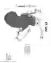 Fig. 13 - Method and system for image processing to determine patient-specific blood flow characteristics