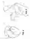 Fig. 05 - Method and system for image processing to determine patient-specific blood flow characteristics