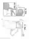Fig. 11 - Method and system for image processing to determine patient-specific blood flow characteristics