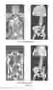 Fig. 04 - Cortical bone segmentation from MR Dixon data