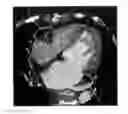 Fig. 01 - Segmentation and matching of structures in medical imaging data