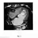 Fig. 02 - Segmentation and matching of structures in medical imaging data