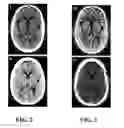 Fig. 03 - Medical image processing method