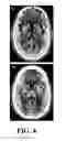 Fig. 04 - Medical image processing method