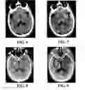 Fig. 06 - Medical image processing method