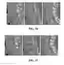 Fig. 07 - Medical image processing method