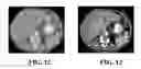 Fig. 08 - Medical image processing method