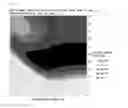 Fig. 04 - Method for forming multi-layer film and patterning process