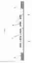Fig. 04 - Method and apparatus for plasma dicing a semi-conductor wafer