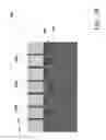 Fig. 05 - Method and structure for FinFET isolation