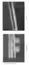 Fig. 24 - NEW STRUCTURE OF MICROELECTRONIC PACKAGES WITH EDGE PROTECTION BY COATING