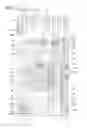 Fig. 11 - Organic light-emitting diode display and method of manufacturing the same