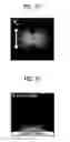 Fig. 12 - Light emitting device having light extraction structure and method for manufacturing the same