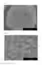 Fig. 04 - POSITIVE ELECTRODE ACTIVE SUBSTANCE PRECURSOR PARTICLES, POSITIVE ELECTRODE ACTIVE SUBSTANCE PARTICLES AND NON-AQUEOUS ELECTROLYTE SECONDARY BATTERY