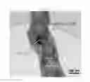 Fig. 16 - Current collector-catalyst monolithic three-dimensional nanofiber network for Li-air batteries and manufacturing method thereof