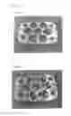 Fig. 14 - Ion/ozone wind generation device and method