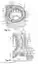 Fig. 05 - Electrical machine with damper to resist vibratory stresses mechanically, and corresponding damper