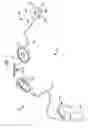 Fig. 02 - Implantable auditory prosthesis with floating mass transducer