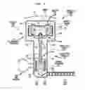 Fig. 06 - Implantable auditory prosthesis with floating mass transducer